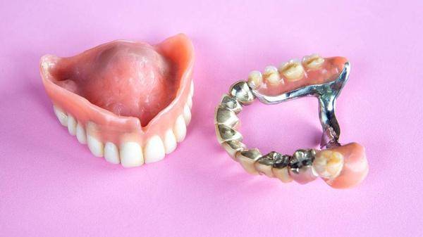 牙齿一旦脱落,究竟该镶牙还是种植牙？选之前不妨先看这4种区别
