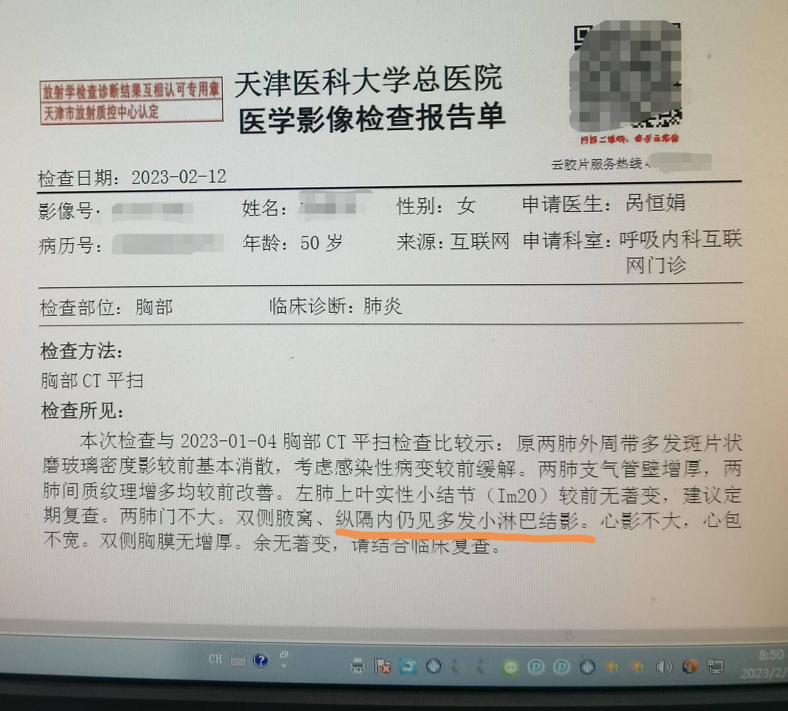 刘懿博士说肺癌(五三一一)淋巴结和肺结节有关么?要做b超么?