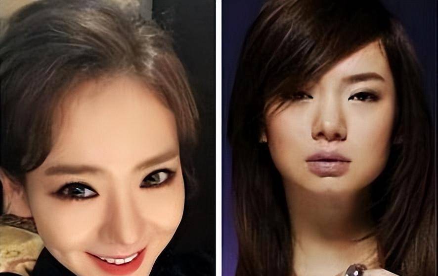 戚薇整容?早期照片曝光,网友直呼前后变化太明显了_发展_风险_长相