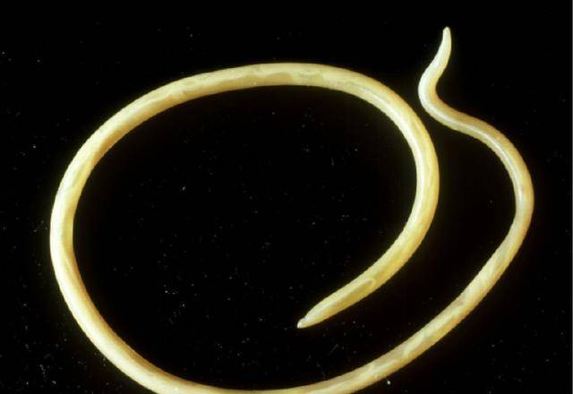 蛔虫视频 来自搜狐网