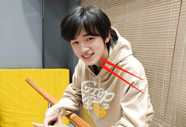 宋亚轩更新自拍照,"鸡腿"头套萌出新高度,年纪小果然有优势吗_照片