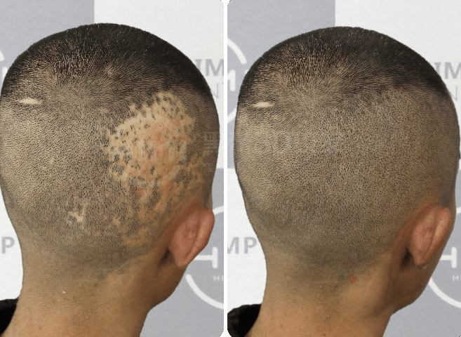 头发_人群_技术