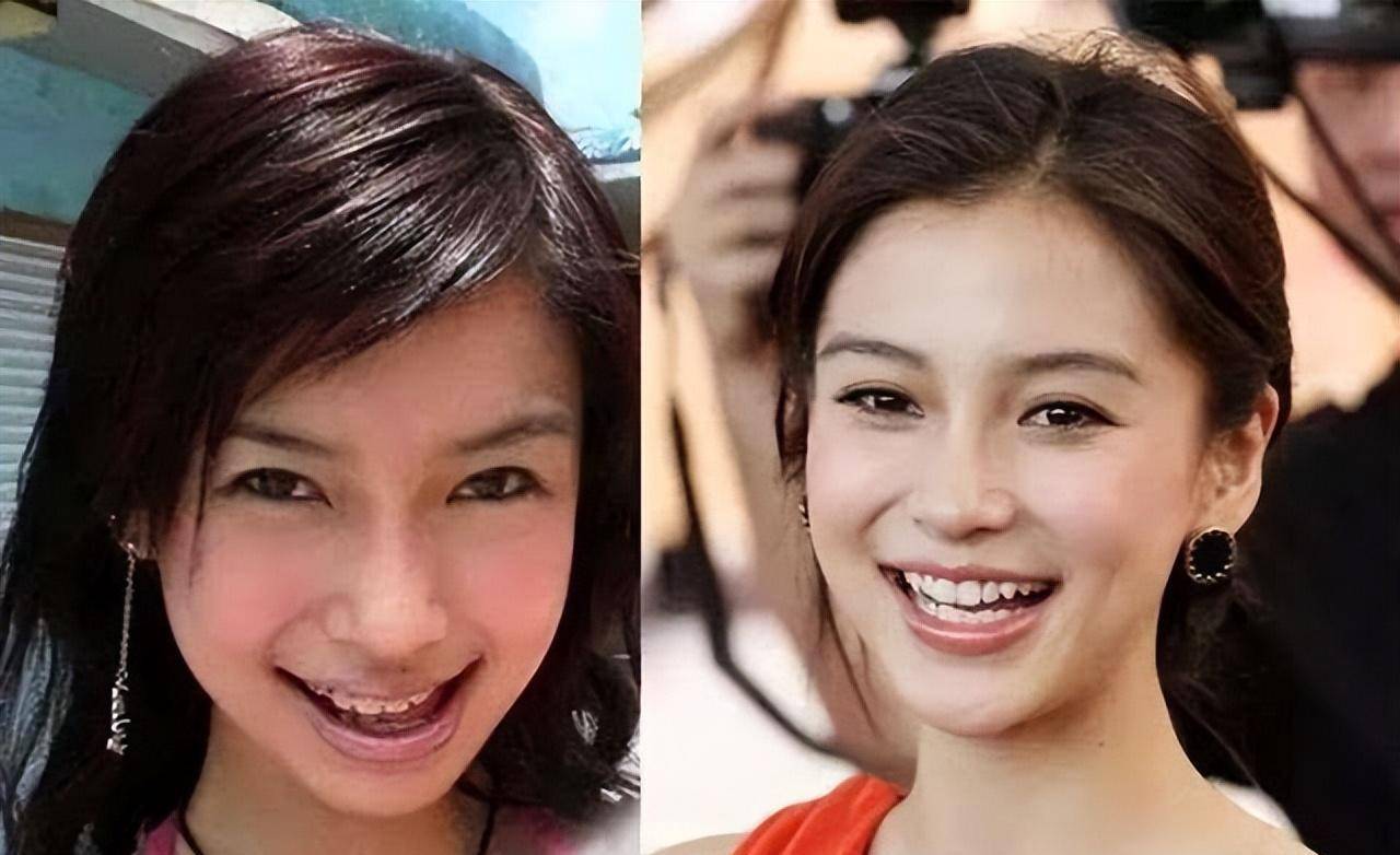 美到认不出来,网友:当年错怪baby了_变化_牙齿_杨颖