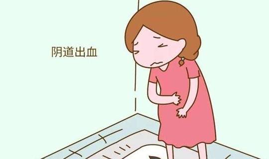 孕妇内裤上有这3种情况,可能是胎儿"呼救"的信号,别傻傻忽略_分泌物