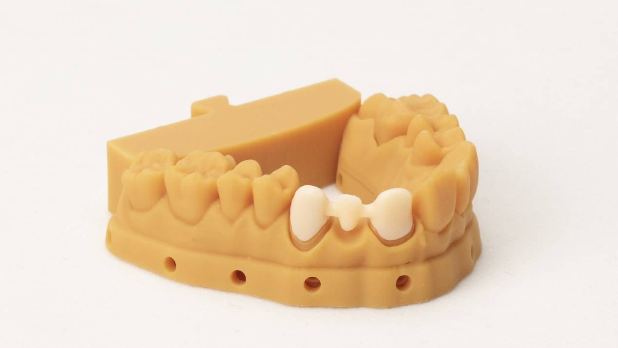 哈工三维-8k齿科3d打印数字化制造 创新"定制"助力患者快速康复_进行