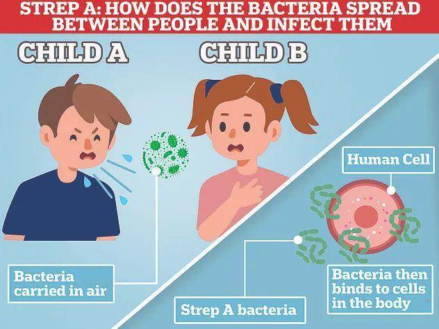 孩子得了链球菌性咽炎会有哪些症状表现 需要哪些检查及如何预防？