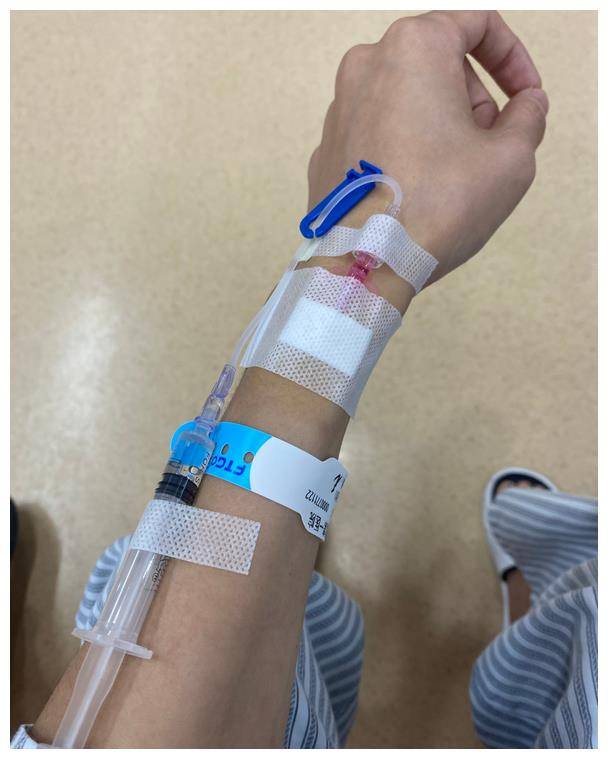 在最近的照片中,他穿着医院的病号服,正在插管输氧.