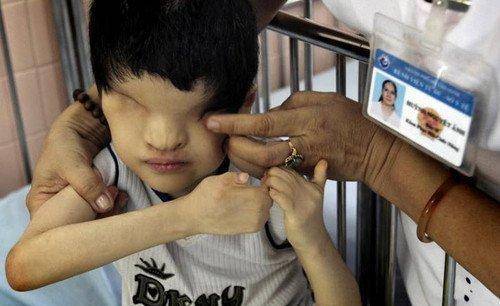 彩超发现胎儿畸形,孕妇称自己身体很好,知道真相后她懊悔不已_影响