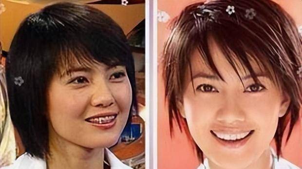 林心如林心如可谓是眉目如画,虎牙俊俏,如果没有整牙的话,就不会有