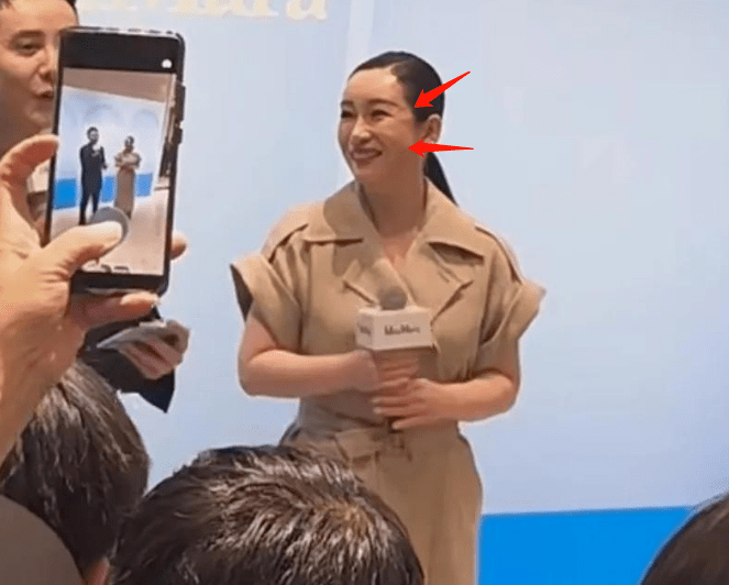 明星脸肿太可怕!额头凸,脸僵硬,秦海璐,杨紫,赵丽颖纷纷中招