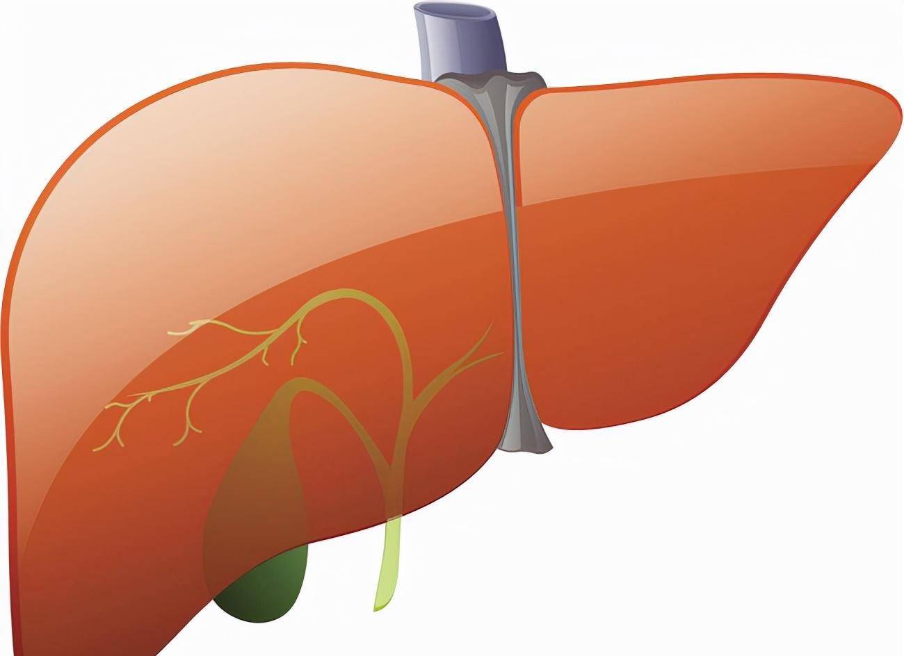 在肝硬化中,门脉压力通常升高,胆囊通常随着肝脏的变化而收缩和上下