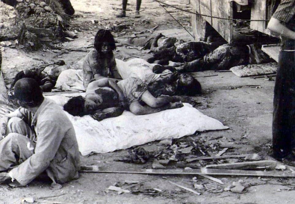 广岛长崎原子弹幸存者:生不如死,充满绝望,身体皮肤狰狞恐怖