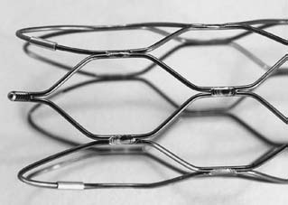 外周血管自扩张镍钛诺支架:材料和设计方面的考虑_钛合金_弹性_应力