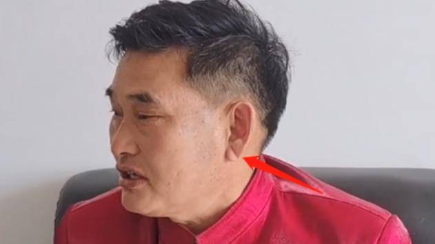 任何了解耳朵状况的人都知道它可能是心脏病发作.