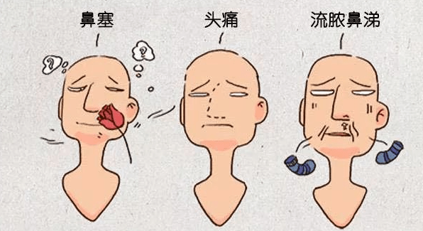 清鼻堂:头晕头痛,可能是儿童鼻窦炎惹的祸!_孩子_症状_分泌物