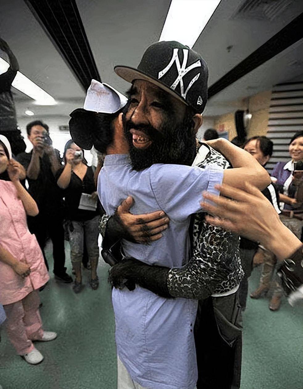 四十几年前,震惊国内外的中国第一毛孩,他现在怎么样了?