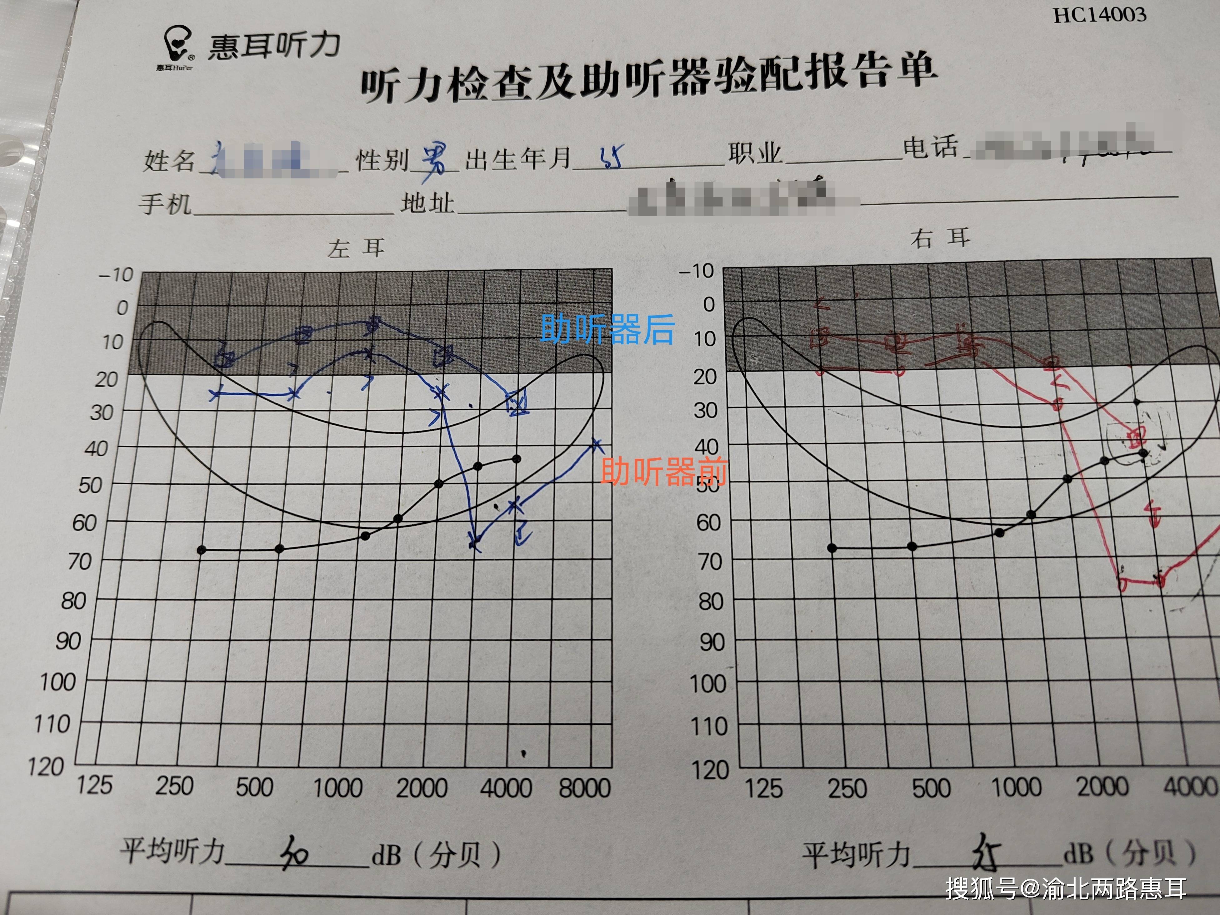 耳镜检查报告图片图片