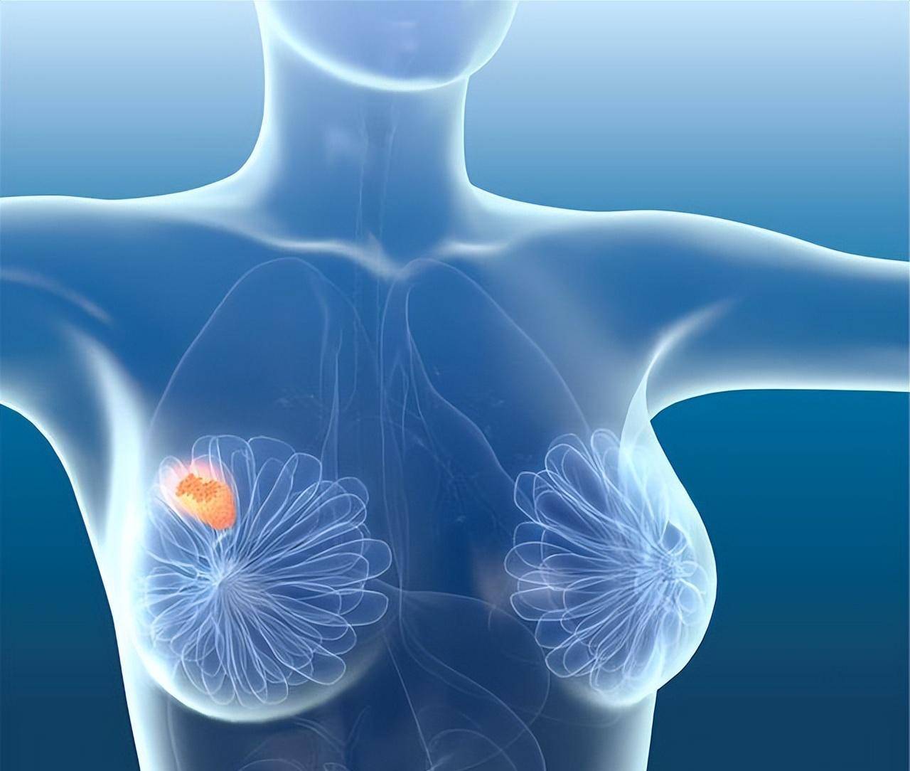 乳腺增生是城市女性的主要高手,日常生活中注意这6点,预防病变
