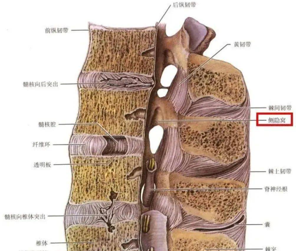 1982 mar; 26(1): 13–20下腰椎正常侧隐窝(箭头)的横断面图,椎孔呈