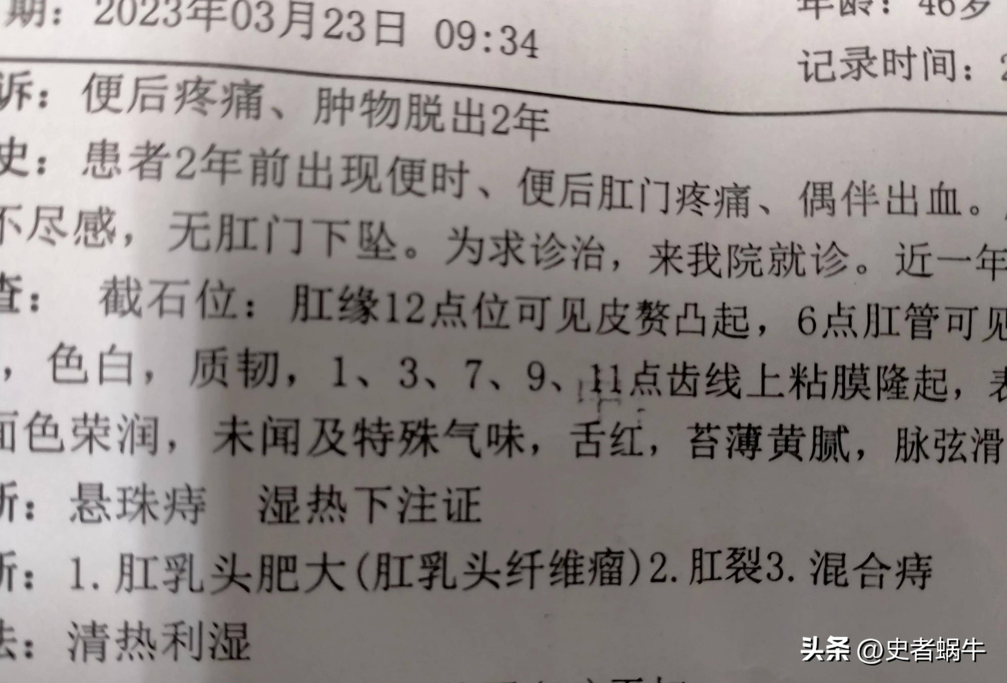 痔疮是属于什么挂号科(痔疮属于什么科挂号什么科)