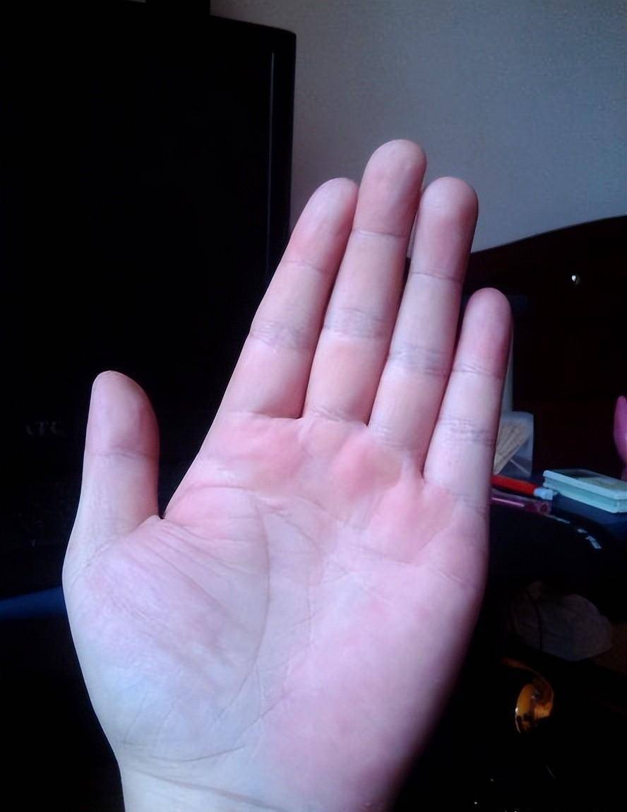 肝不好,坚持3个习惯,可降酶养肝_肝部_手指_陈先生