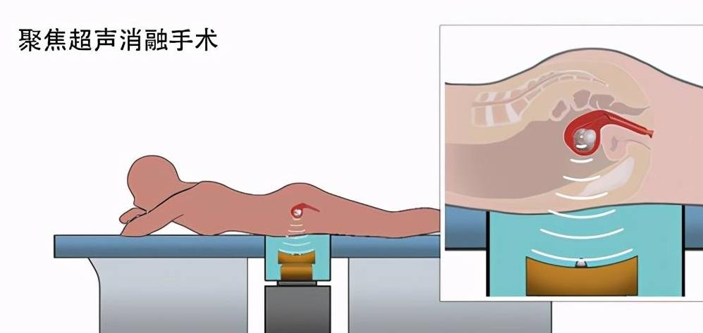 学会了吗（怀孕大肚子痛苦恶搞）怀孕大肚子肚子疼视频女人 第5张