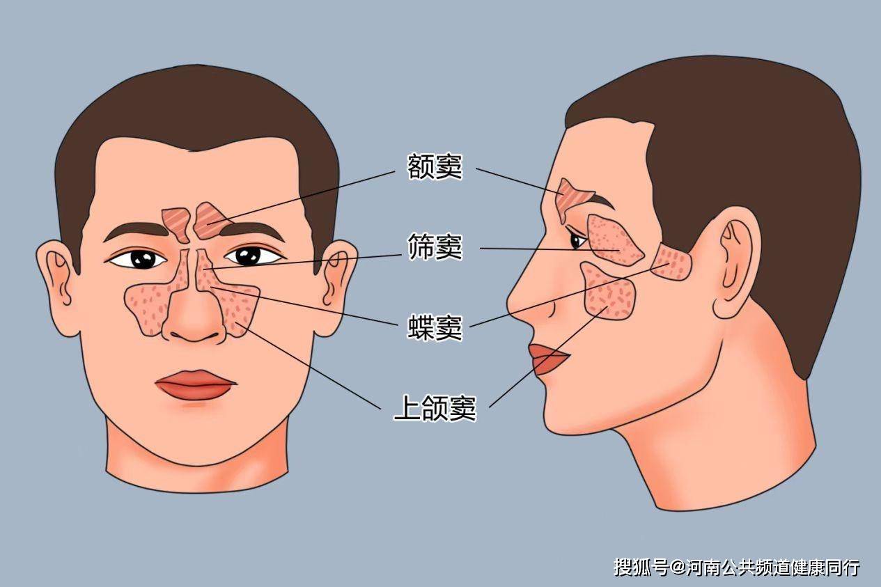 疾病诊断_包括_鼻窦