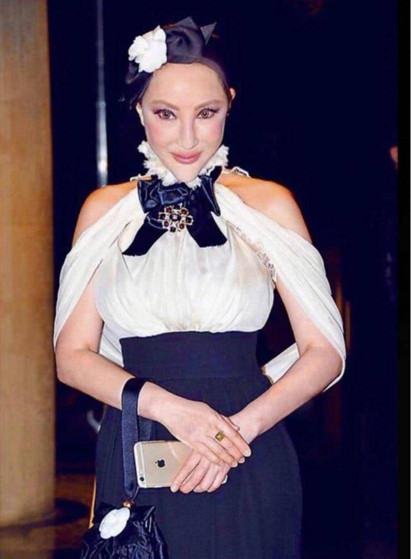 薛芷伦为美整容,前后对比反差大,满满玻尿酸感