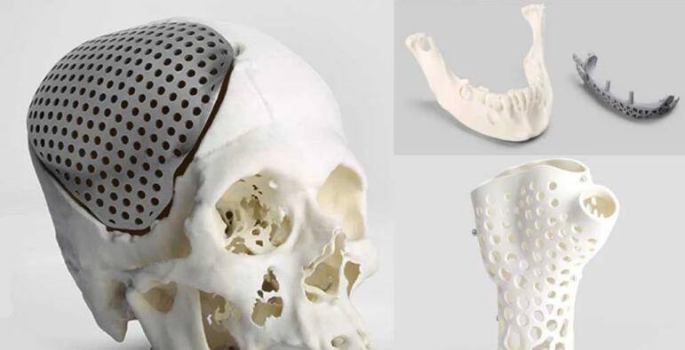 3d打印技术:运用于医学教学与手术,以口腔颌面治疗为例_操作_解剖