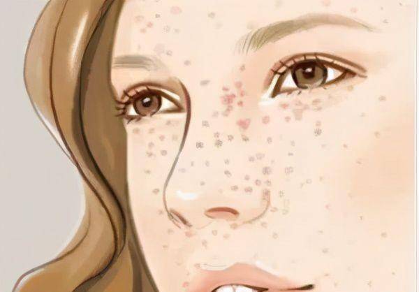 仲景利湿第一方,利湿消斑,重回青春_情况_阳气_效果