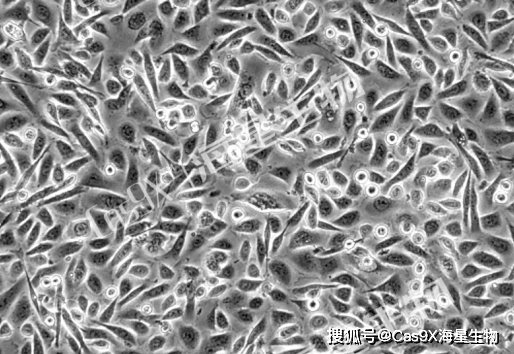 SW480人结肠腺癌细胞的培养与应用_手机搜狐网