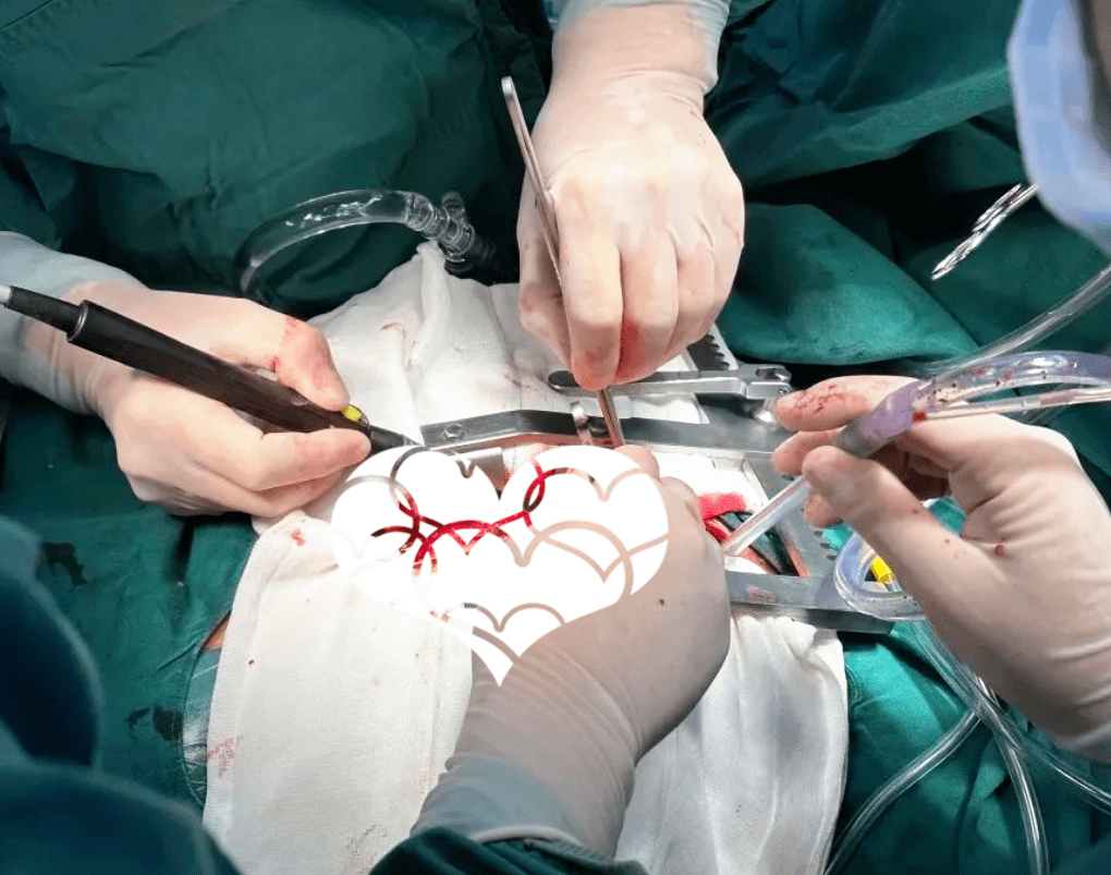 感谢西区医院,我的人造心脏瓣膜置换手术很成功!