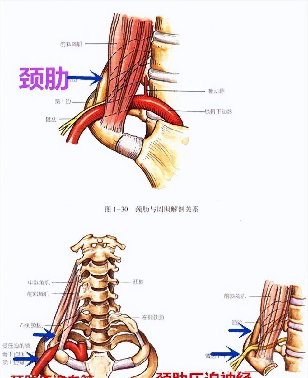 前中后斜角肌图片