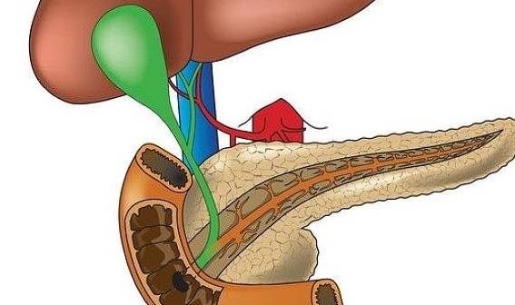 a膽囊息肉發生與飲食沒有關聯膽囊息肉是生長在膽囊粘膜上的贅生物,又