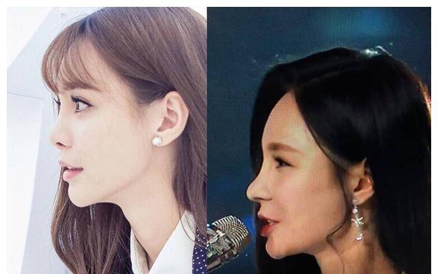 "鼻子不好看"太拉低颜值了,9位女星貌美如花,却被鼻子拖后腿_谭松韵