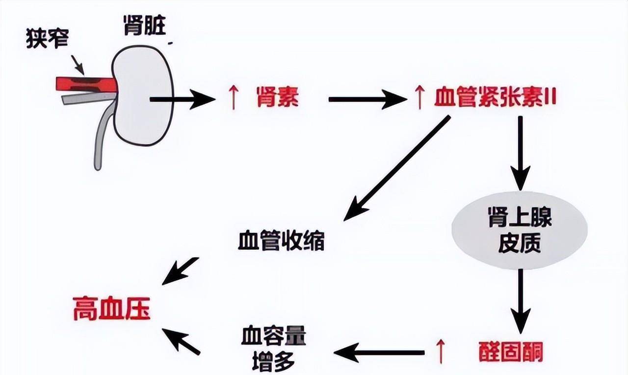 主要调节过程为当血容量降低或肾脏血流灌注不足时,体内的血管紧张素