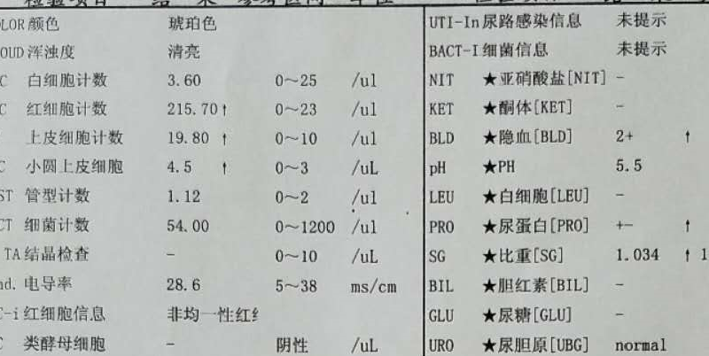 尿潛血陽性,以為自己得了腎炎,檢查發現卻是