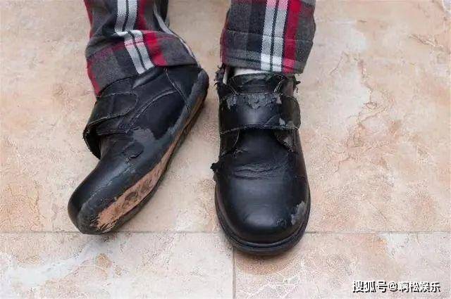 的鞋子不透气的鞋子穿多了,是很容易出现真菌感染,诱发脚气等疾病的