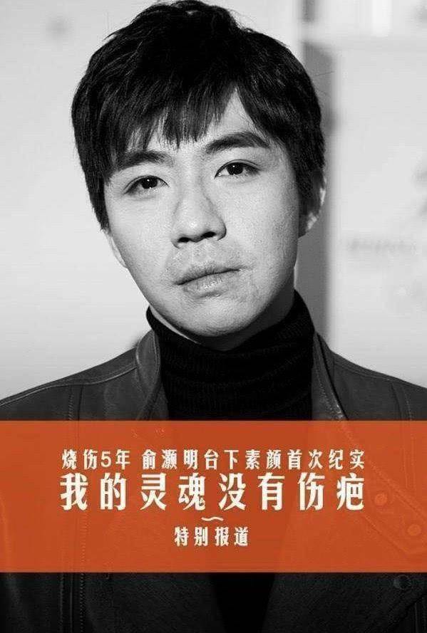 33岁俞灏明凭借《大明风华》再度翻红,演技获观众大赞!