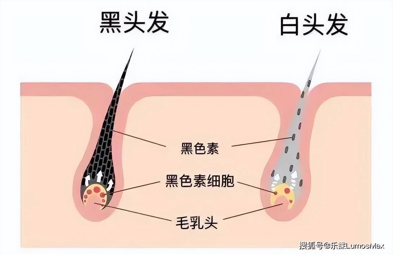 白发变黑发的最好方法是什么?2个小方法,让黑头发慢慢长回来!