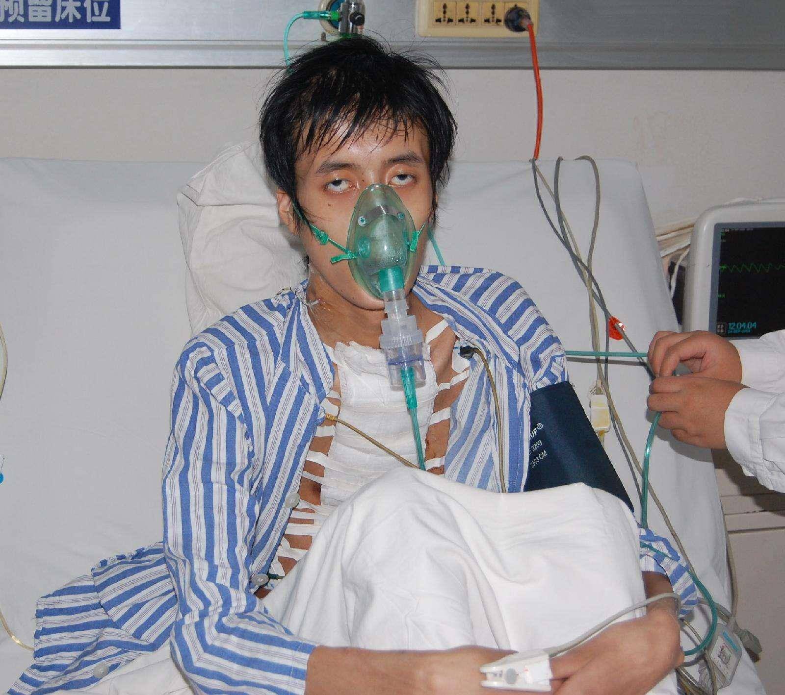 马凡综合征是什么病,能治好吗?外科医生有哪些治疗建议?