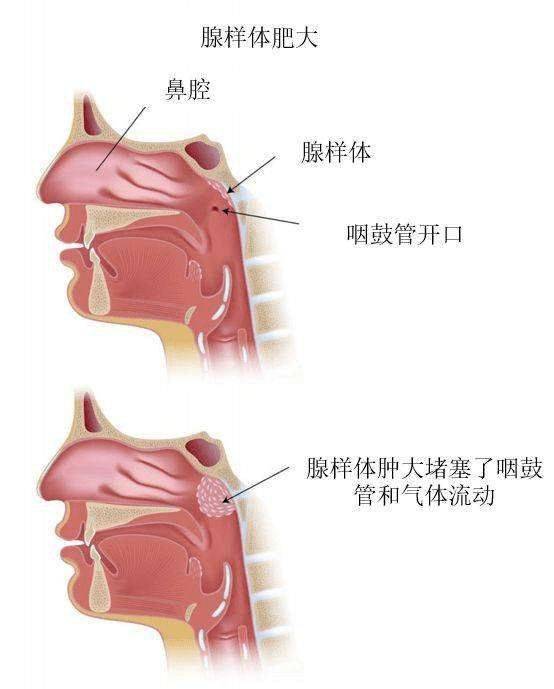 正常的鼻咽部平面图片图片