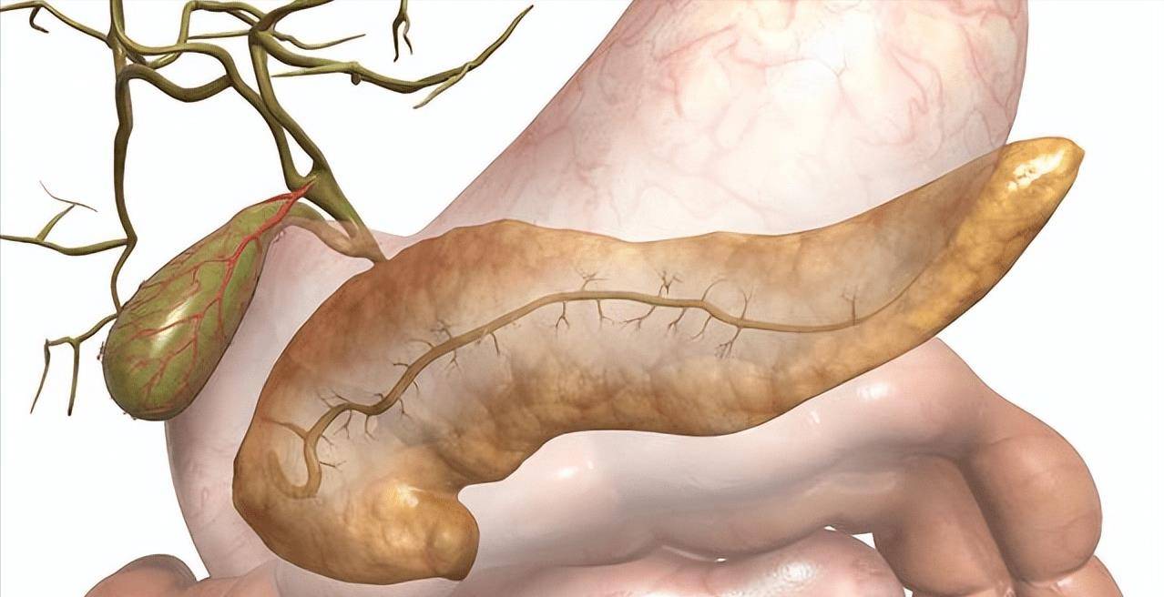 体外冲击波碎石联合内镜取石治疗慢性胰腺炎胰管结石有何优势?