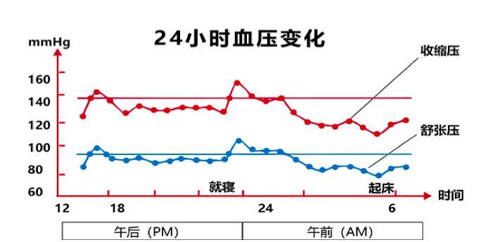 人体血压24小时走势图图片