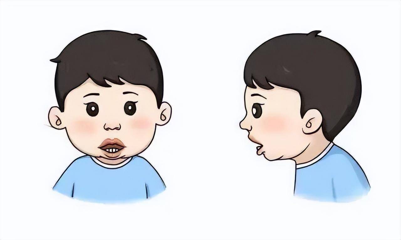 进行_因素_畸形