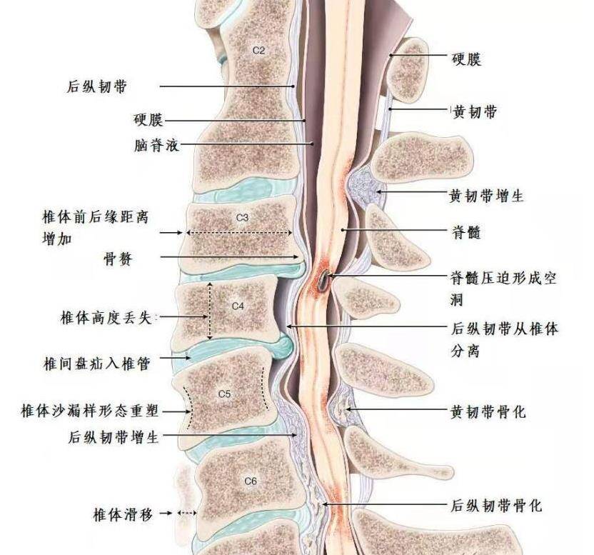 腰椎后纵韧带解剖图图片