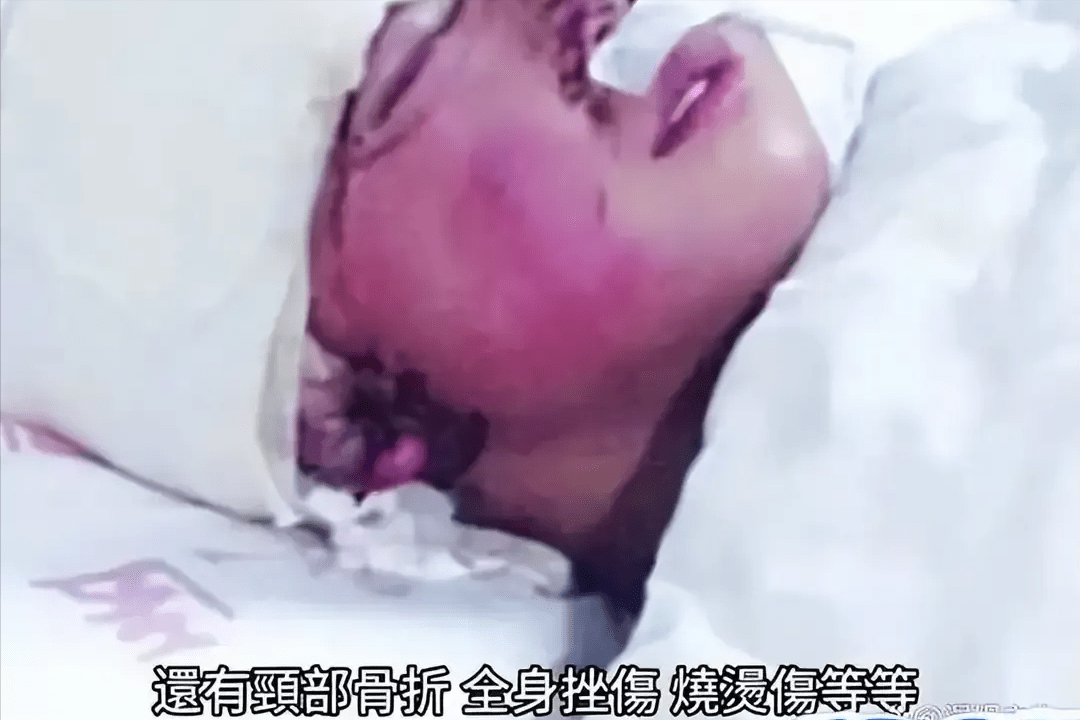 可怕!网红边娥英命丧柬埔寨,身裹红布被扔水沟,骨折满身伤痕