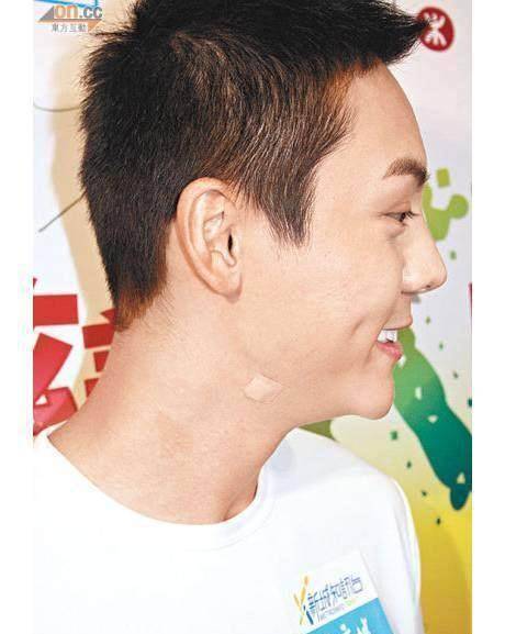 杨幂,陈伟霆,娜扎都中招了!_脖子_问题_古力娜扎