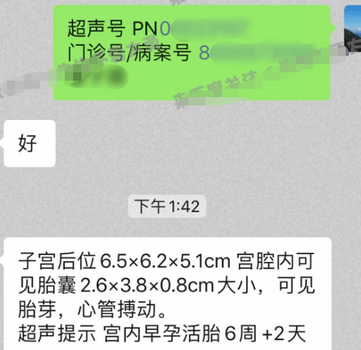 曝蔡徐坤一夜情致女方怀孕堕胎,蔡母派人跟踪,女方指证