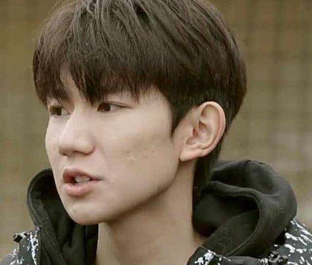 王源在颜值低谷期录制综艺,脸颊深陷令人心疼_伯克利_林妙可_痘痘